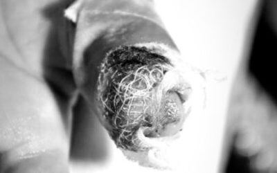 Hombre de 21 años es el nuevo quemado por pólvora en Ibagué